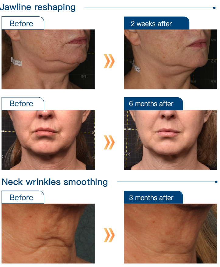 Comparison before and after treatment